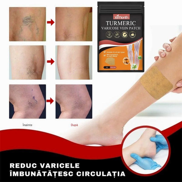 Plasturi Varice cu Turmeric - VenoCalm